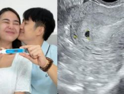 Amanda Manopo Umumkan Kehamilan dengan Lucu, Foto USG Janin Jadi Sorotan