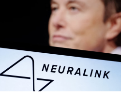 Elon Musk Siap Produksi Massal Chip Otak Neuralink