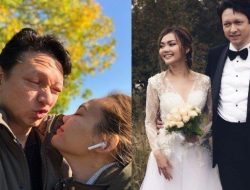 Rina Nose Operasi Hidung, Sudah Dipikirkan 10 Tahun